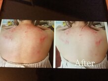 プライベート空間で人目を気にせずかっさが受けられます