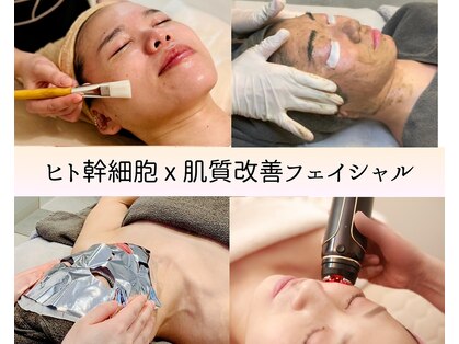 パールムーン(pearl moon)の写真