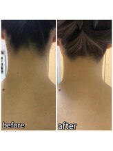 パーソナルエステティックサロン リボーン(ReBorn)/