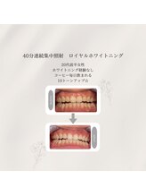 プラスビーセルフ(+b self)/ホワイトニングビフォーアフター