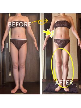 アーユルヴェーダアンドアロマエステ アユス(AYUS)/【40代】施術前後☆スッキリ