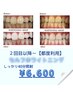 《2回目～都度利用》美白セルフホワイトニング40分照射¥6600