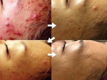 至空院/ハーブトリートメント