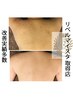 【剥離あり/ニキビケア】リベルハーブピーリング背中上（2000円券付）