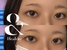 メエ(MEE)/アンドヘルシー☆フラット80本