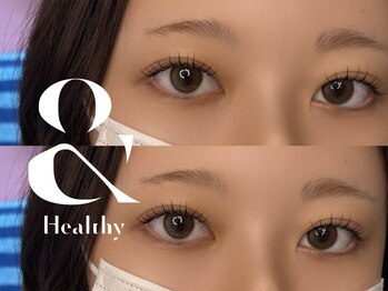 メエ(MEE)/アンドヘルシー☆フラット80本