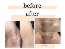 グレイスアップ(Grace-up)の雰囲気（脱毛、フェイシャル共に結果重視のサロンです。）