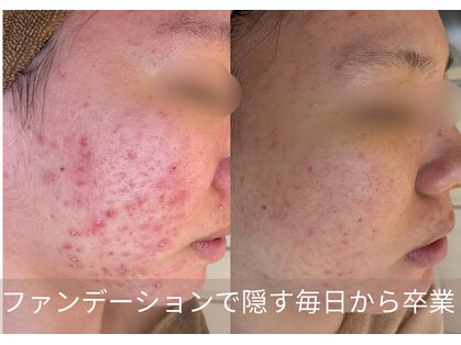 ポアレ(POARE)の写真
