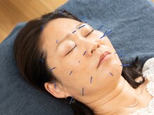 グリーンルーム鍼灸治療院の雰囲気（おひとりお一人に合わせたオーダーメイド施術でお悩みを改善。）