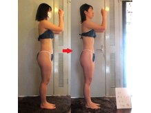 痩身 セル脂肪専門 スタイルデザイン/くびれキターー！！施術６回