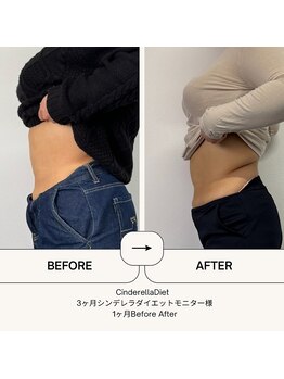 オーシャン整骨院(OCEAN整骨院)/ダイエット３ヶ月コース