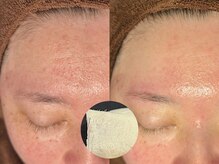 ルーナジェーナ(Luna llena)/池袋　エステ　ルーナジェーナ