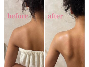 ウンスイスパ(UNSUI SPA)/徹底背中痩せ！