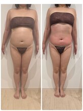 ありひ/セルゼロの効果！！