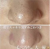 カピリナ(ka pilina)