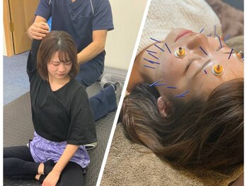 アパト鍼灸院(APaT)の写真/土台から整う美姿勢＆美小顔に◎【マットピラティス30分¥3000／マットピラティス30分＋美容鍼灸30分¥6000】