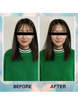 スーコ(SU:CO)/ビフォアフ　小顔→さらに小顔