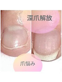 毎日目にする爪だから