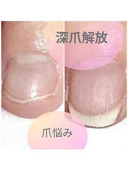 エルアンド(elle＆)/毎日目にする爪だから