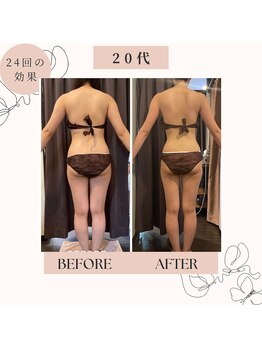 ビープロデュース 尾張旭店(B' PRODUCE)/20代 90分メニュー 24回