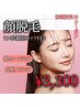 [パーツ脱毛]顔丸ごと脱毛＋ヒト幹細胞パック付き！¥3,300