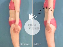 ピュアエステ ブリアント 松戸店/お客様の結果［松戸］