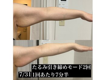 アモ(amo.)/ウィンバック効果写真