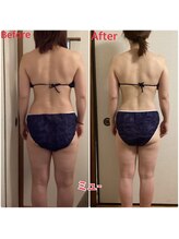 ミュー 新小岩店(Mieux)/Wマシン×痩身リンパ＋発汗120分