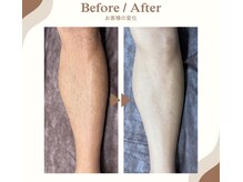 メンズも大歓迎◎面倒な自己処理からも解放♪