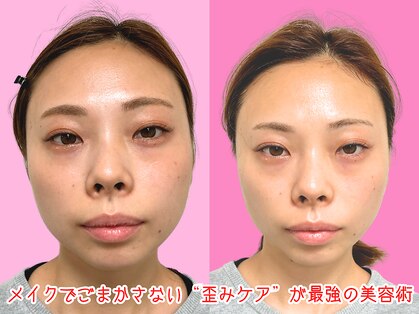 ナチュラルパーフェクトフェイス 新宿の写真