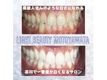 ライトビューティー 本八幡店(LIGHT BEAUTY)/お客様ビフォーアフター♪ 