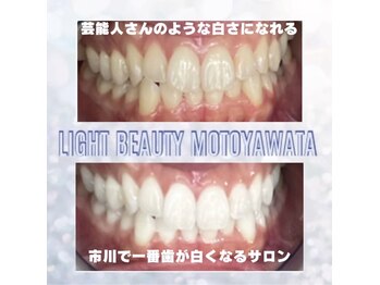 ライトビューティー 本八幡店(LIGHT BEAUTY)/お客様ビフォーアフター♪ 
