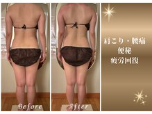 チャーム(Charm)/痩身80分　１回