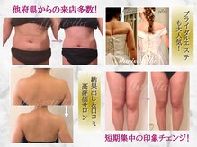 マリスステラ 天王寺(MarisStella)