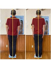 なないろカイロプラクティック院/カイロ整体ビフォーアフター