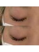 バニーアイズ 天神(Bunny eyes TENJIN)/フラット120本