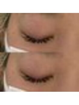 バニーアイズ 天神(Bunny eyes TENJIN)/フラット120本