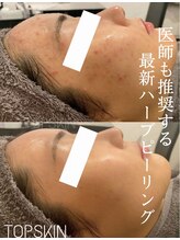 トップスキン 表参道(TOPSKIN)&nbsp;一生モノの 肌を創る