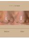 パンセリーノ(Panselinos)の写真/大人世代の毛穴悩みに◎毛穴専用美容液導入と大人気モデリングパックで引き締め♪