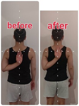 コトリ(KOTORI)/パルストリートメント2