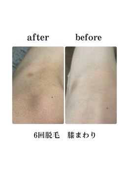 エステティックレイビス 弘前店(RAYVIS)/