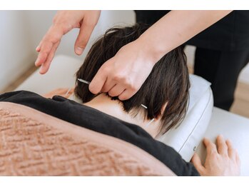 フィット鍼灸整骨院 国領院/鍼