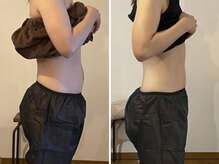 1回の施術でむくみが解消し、お腹まわりもスッキリ♪