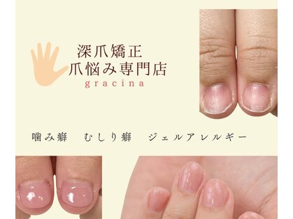 グレースレディ 大阪店の写真