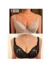 美人バスト 表参道店/【バストアップ/育乳 症例】