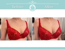 美人バスト 赤羽店/【バストアップ★育乳】症例