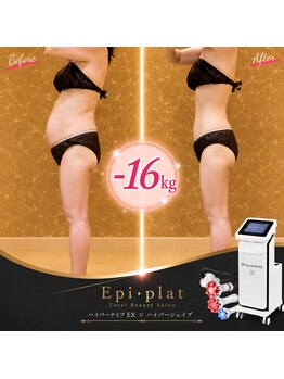 エピファニー(Epi phany Total Beauty Salon)の写真/昔と同じダイエットでは落ちなくなった部分に脂肪に徹底アプローチで見た目の変化を◎大人女性の本気痩身