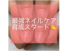 【3ヶ月で自爪を美爪に育てる】最強のネイルケア導入サロン