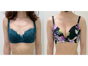 ワイサロン(Y salon)/40代産後バスト8ヶ月/D→Eカップ