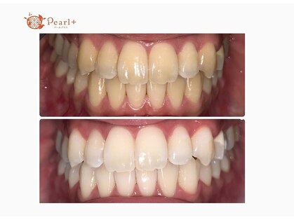 パールプラス 瑞浪店(Pearl plus)の写真